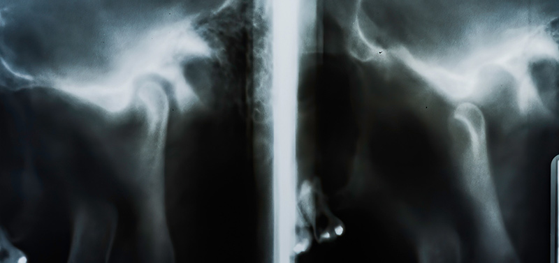 TMJ Treatment in Childersburg / Inverness
