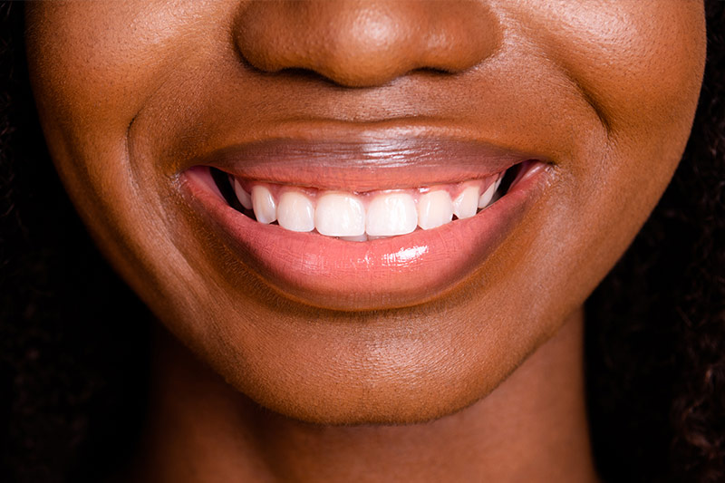Gum Contouring in Childersburg / Inverness