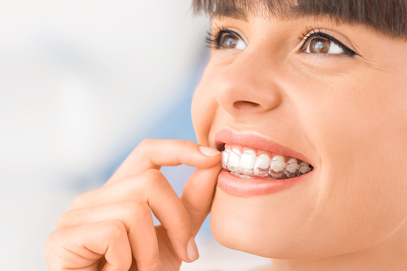 Prime Smile Dental Care Invisalign Special Offer