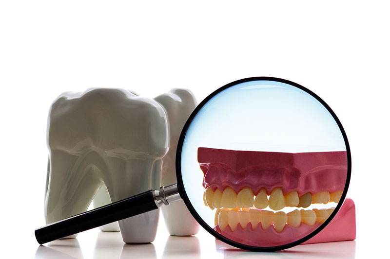 Root Canal in Childersburg / Inverness