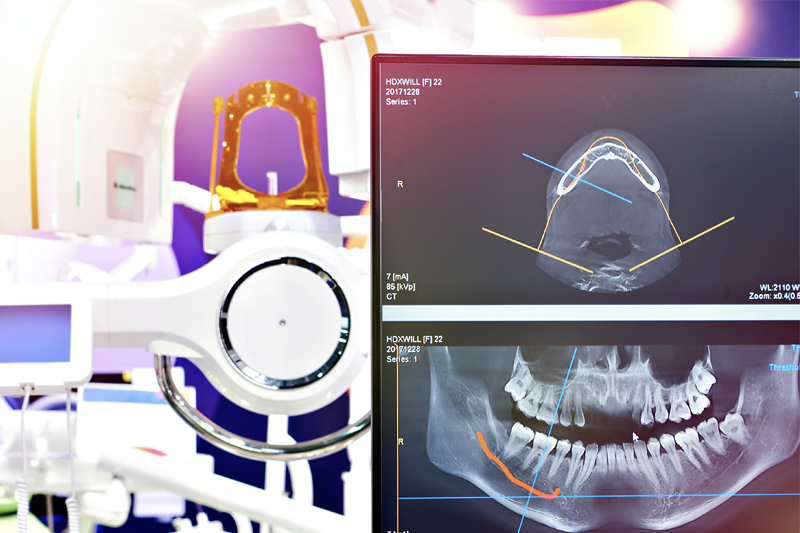 Digital X-Rays in Childersburg / Inverness